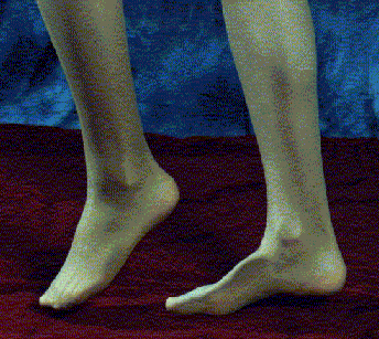 feet3.gif (49947 byte)