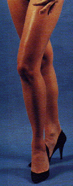 legs1.gif (14383 byte)